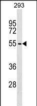 WB - ZBTB6 Antibody (C-term) AP17721b