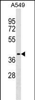 WB - ZCCHC12 Antibody (C-term) AP17722b