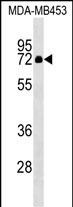 WB - ZNF57 Antibody (N-term) AP17724a