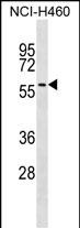 WB - UGT2A3 Antibody (Center) AP17728c