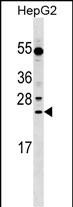 WB - LRRC29 Antibody (N-term) AP17734a