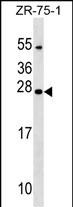 WB - NXNL1 Antibody (Center) AP17740c