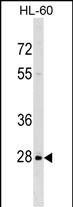 WB - PPIL6 Antibody (N-term) AP17743a