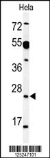 WB - AKIR1 Antibody (C-term) AP17755B