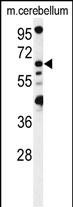 WB - MON1B Antibody  (C-term) AP17756b