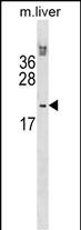 WB - Mouse Hoxb6 Antibody (N-term) AP17806a