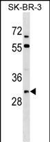 WB - Mouse Tssk3 Antibody (C-term) AP17810b