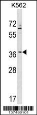 WB - ZNF385A Antibody (N-term) AP17816a