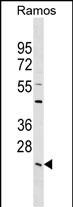 WB - LYPLA2 Antibody (C-term) AP17835B
