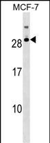 WB - RNASE11 Antibody (Center) AP17847c