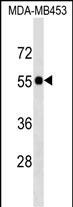 WB - SCLY Antibody (N-term) AP17849a
