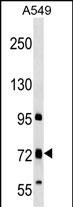 WB - TMC4 Antibody (N-term) AP17860a