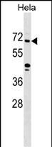 WB - ZNF280B Antibody (N-term) AP17865a