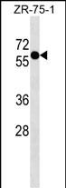 WB - ZNF503 Antibody (N-term) AP17866a