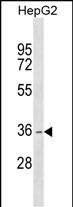 WB - DHRS1 Antibody (Center) AP17869c