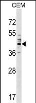 CEACAM6 Antibody (Center) (Cat. #AP17875c) western blot analysis in CEM cell line lysates (35ug/lane).This demonstrates the CEACAM6 antibody detected the CEACAM6 protein (arrow).