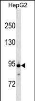 ANAPC4 Antibody (Center) (Cat. #AP17878c) western blot analysis in HepG2 cell line lysates (35ug/lane).This demonstrates the ANAPC4 antibody detected the ANAPC4 protein (arrow).