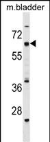 WB - CECR6 Antibody (C-term) AP17883b