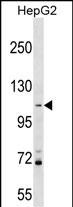 WB - PROSER1 Antibody (N-term) AP17899a