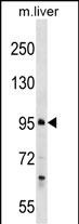 WB - PROSER1 Antibody (N-term) AP17899a