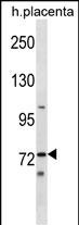 WB - Mouse Sgk071 Antibody (N-term) AP17917a