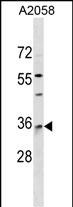 WB - RAB40A Antibody (Center) AP17918c