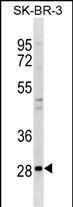WB - ZNF688 Antibody (N-term) AP17928a