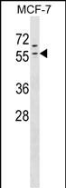 WB - ZNF383 Antibody (N-term) AP17940a