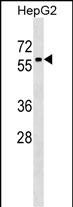 WB - ZNF419 Antibody (Center) AP17941c