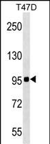 WB - ZNF606 Antibody (N-term) AP17945A