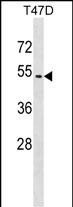 WB - ZNF713 Antibody (Center) AP17948c
