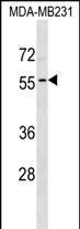 WB - ADAT1 Antibody (N-term) AP17954a