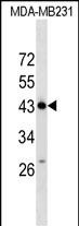 ZNF550 Antibody (N-term) (Cat. #AP17984a) western blot analysis in MDA-MB231 cell line lysates (35ug/lane).This demonstrates the ZNF550 antibody detected the ZNF550 protein (arrow).