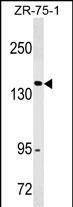 ITGAX/CD11c Antibody (N-term) (Cat. #AM2013b) western blot analysis in ZR-75-1 cell line lysates (35?g/lane).This demonstrates the ITGAX/CD11c antibody detected the ITGAX/CD11c protein (arrow).