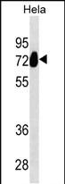 ALPP Antibody (N-term) (Cat. #AM2022b) western blot analysis in Hela cell line lysates (35?g/lane).This demonstrates the ALPP antibody detected the ALPP protein (arrow).