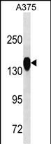 ANPEP Antibody (Cat. #AM2063b) western blot analysis in A375 cell line lysates (35?g/lane).This demonstrates the ANPEP antibody detected the ANPEP protein (arrow).