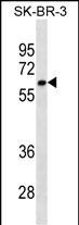 CYP1A2 Antibody (Cat. #AM2066a) western blot analysis in SK-BR-3 cell line lysates (35?g/lane).This demonstrates the CYP1A2 antibody detected the CYP1A2 protein (arrow).