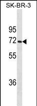 CYP1A2 Antibody (Cat. #AM2066b) western blot analysis in SK-BR-3 cell line lysates (35?g/lane).This demonstrates the CYP1A2 antibody detected the CYP1A2 protein (arrow).