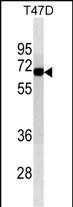ALB Antibody (Cat. #AM2069b) western blot analysis in T47D cell line lysates (35?g/lane).This demonstrates the ALB antibody detected the ALB protein (arrow).