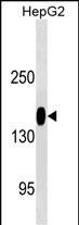 ANPEP/CD13 Antibody (Cat. #AM2079b) western blot analysis in HepG2 cell line lysates (35?g/lane).This demonstrates the ANPEP/CD13 antibody detected the ANPEP/CD13 protein (arrow).