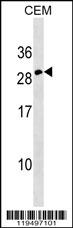 Erythropoietin Antibody (C-term) (Cat. #AP17987b) western blot analysis in CEM cell line lysates (35ug/lane).This demonstrates the Erythropoietin antibody detected the Erythropoietin protein (arrow).