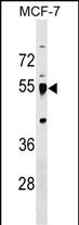 WB - LRRC42 Antibody (Center) AP17990c