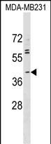 ABO Antibody (N-term) (Cat. #AP17996a) western blot analysis in MDA-MB231 cell line lysates (35ug/lane).This demonstrates the ABO antibody detected the ABO protein (arrow).