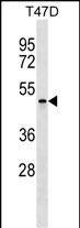 WB - APOBEC4 Antibody (Center) AP18000c