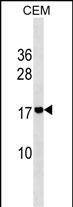 ADM2 Antibody (N-term) (Cat. #AP18001a) western blot analysis in CEM cell line lysates (35ug/lane).This demonstrates the ADM2 antibody detected the ADM2 protein (arrow).