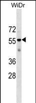 AGPAT9 Antibody (Center) (Cat. #AP18013c) western blot analysis in WiDr cell line lysates (35ug/lane).This demonstrates the AGPAT9 antibody detected the AGPAT9 protein (arrow).