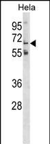 WB - GLT11 Antibody (N-term) AP18017A