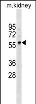 WB - GLT11 Antibody (N-term) AP18017A