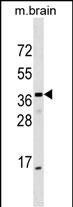 WB - ELMOD1 Antibody (Center) AP18029c