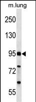 WB - FCHO2 Antibody (Center) AP18034c